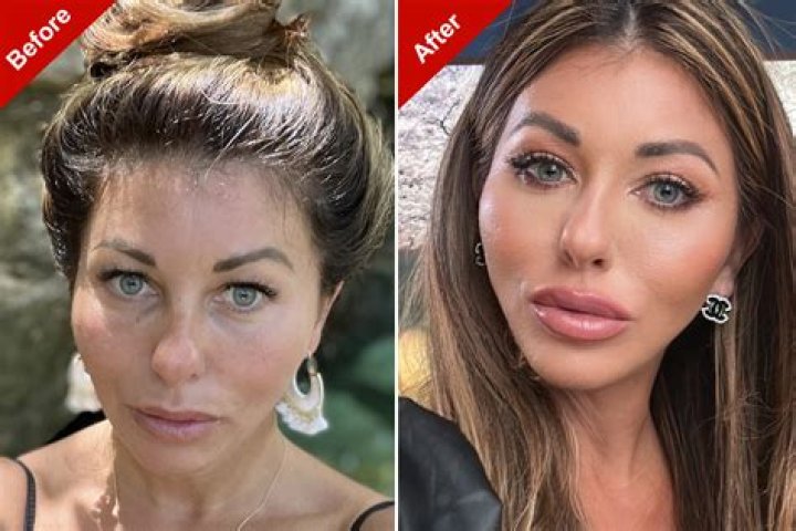 Did Jenny Marrs Get Her Lips Done? Plastic Surgery Before And After Photos