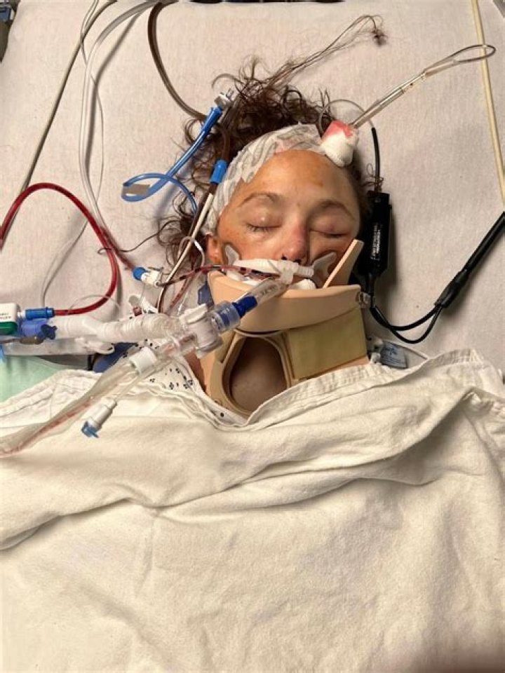 What Happened To Patrick Teichert? Bodybuilder Was In Coma After Accident, Full Story